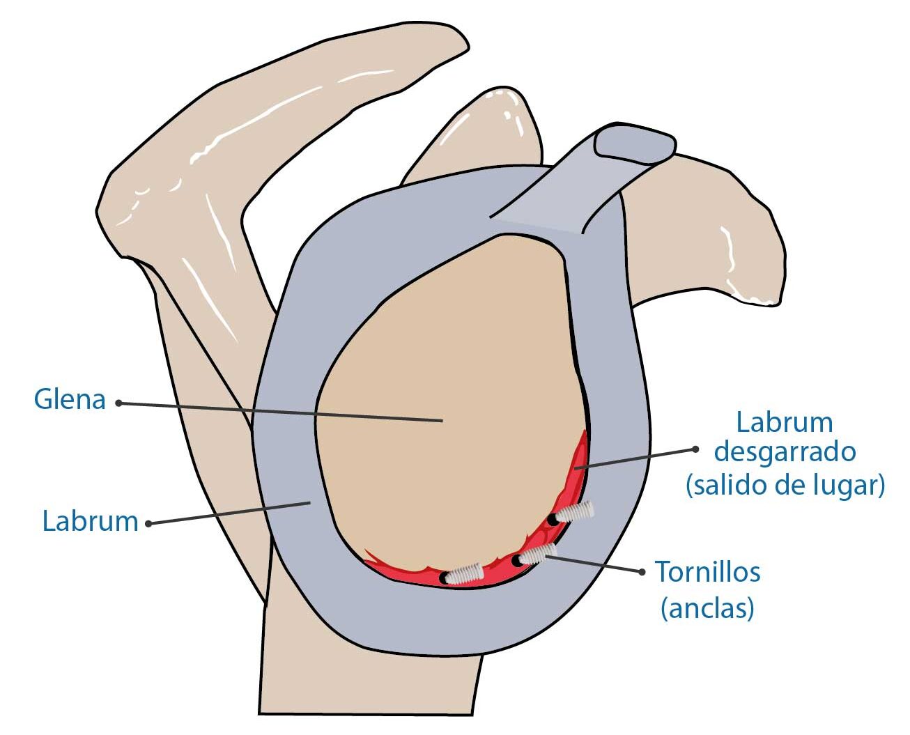 Ted Labrum ¿Qué Es El Labrum Del Hombro , El labrum en la articulación del hombro ...